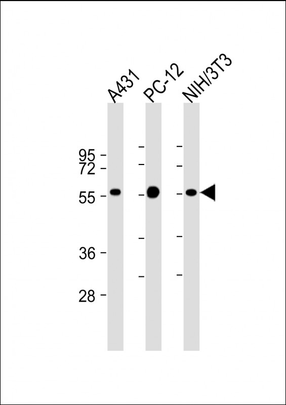 Mouse anti-MITF Monoclonal Antibody(1607CT834.207.47)