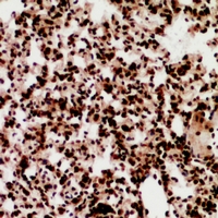 Rabbit anti-ZNF600 Polyclonal Antibody