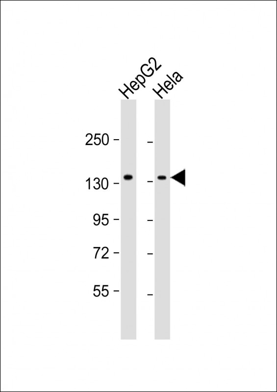 Mouse anti-RBM6 Monoclonal Antibody(1583CT111.17.7.37)