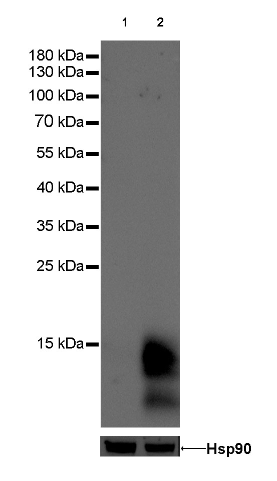 Rabbit anti-GCDFP-15 Monoclonal Antibody(010-579)