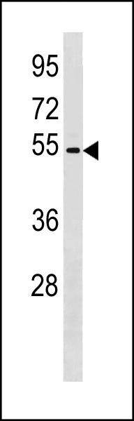 Rabbit anti-ZNF577 Polyclonal Antibody(N-term)