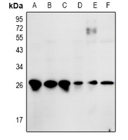 Rabbit anti-ZNF575 Polyclonal Antibody