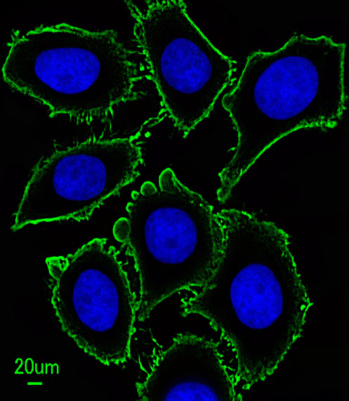 Mouse anti-KIT Monoclonal Antibody(566CT8.5.4)