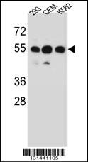 Rabbit anti-ZNF562 Polyclonal Antibody(N-term)