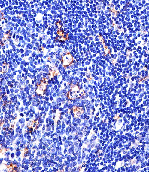 Mouse anti-ITGB2 Monoclonal Antibody(534CT6.2.1)