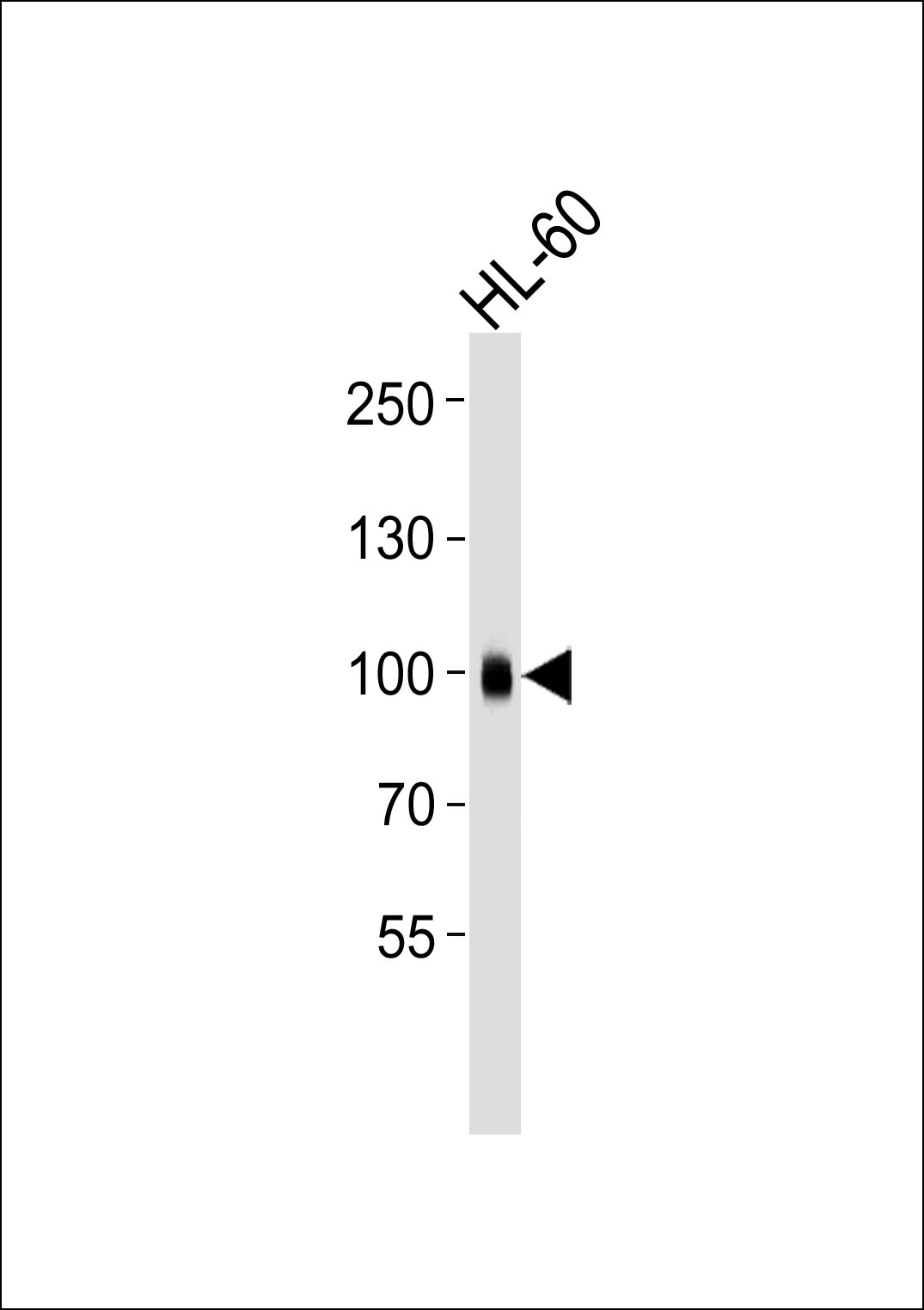 Mouse anti-ITGB2 Monoclonal Antibody(534CT6.2.1)