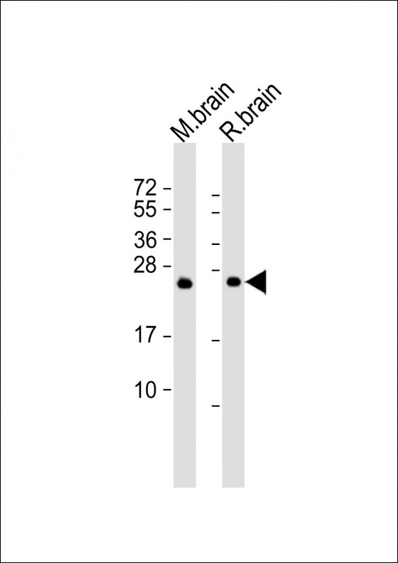 Mouse anti-RAB3A Monoclonal Antibody(1531CT562.14.57)