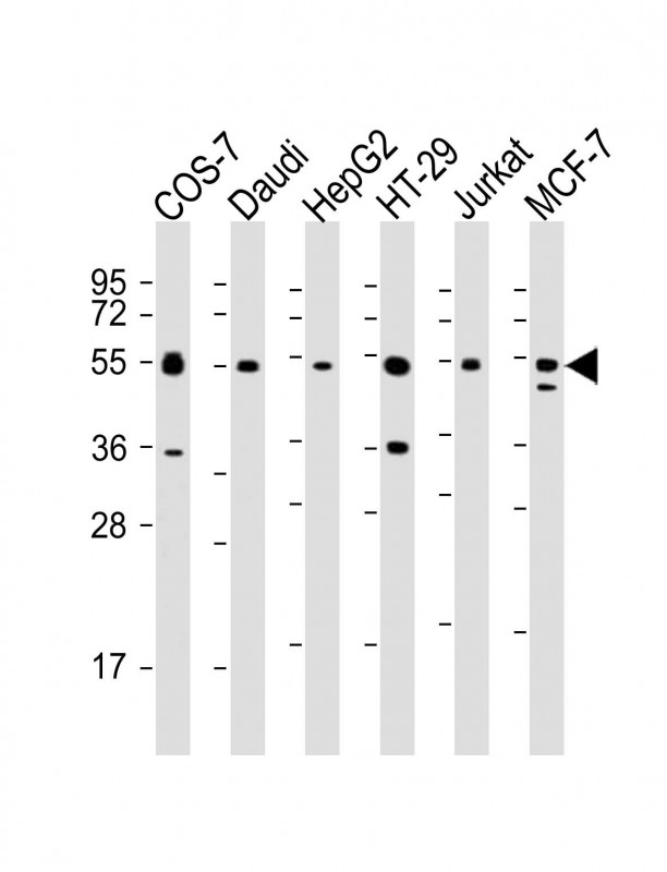 Mouse anti-IRF3 Monoclonal Antibody(1522CT766.58.24)