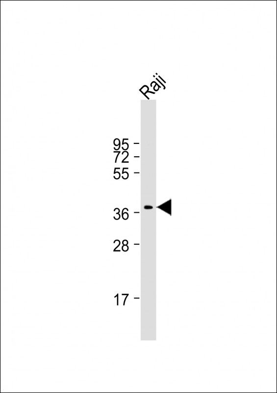 Mouse anti-RASSF2 Monoclonal Antibody(1509CT269.10.9.29)