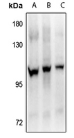 Rabbit anti-FGFR4(pY642) Polyclonal Antibody