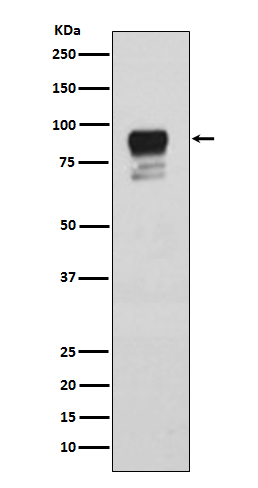 Rabbit anti-Phospho-Glycogen Synthase(Ser641) Polyclonal Antibody