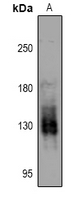 Rabbit anti-PKN1/2(pT774/816) Polyclonal Antibody